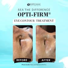 Repechage Opti-Firm Eye Contouring Treatment